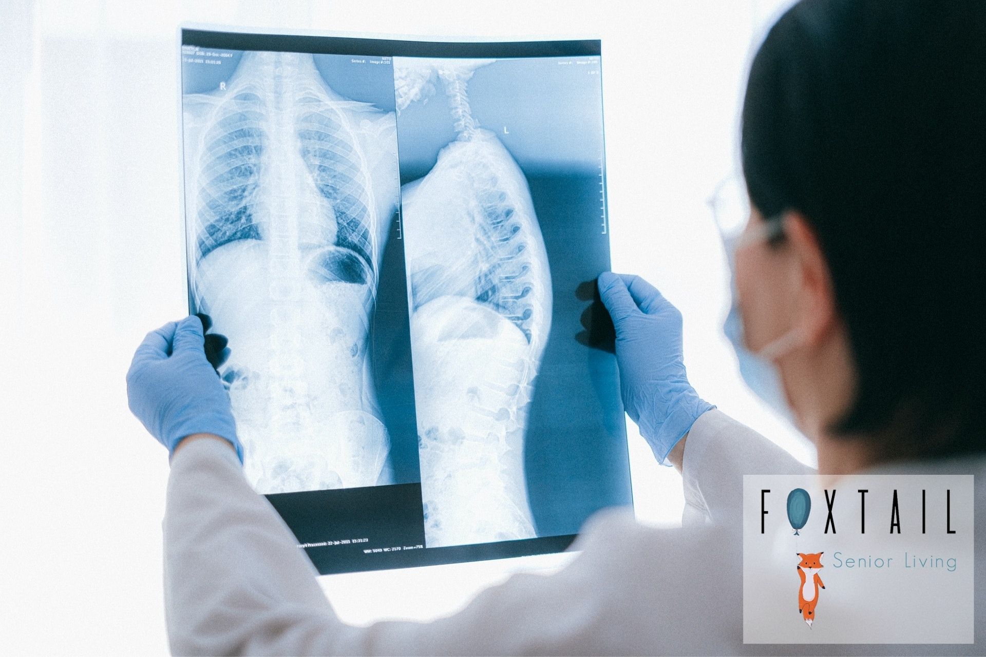 Doctor holding an X-ray of a patients lungs, bones, and other organs